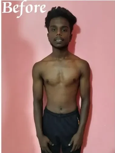 Before lean transformation program